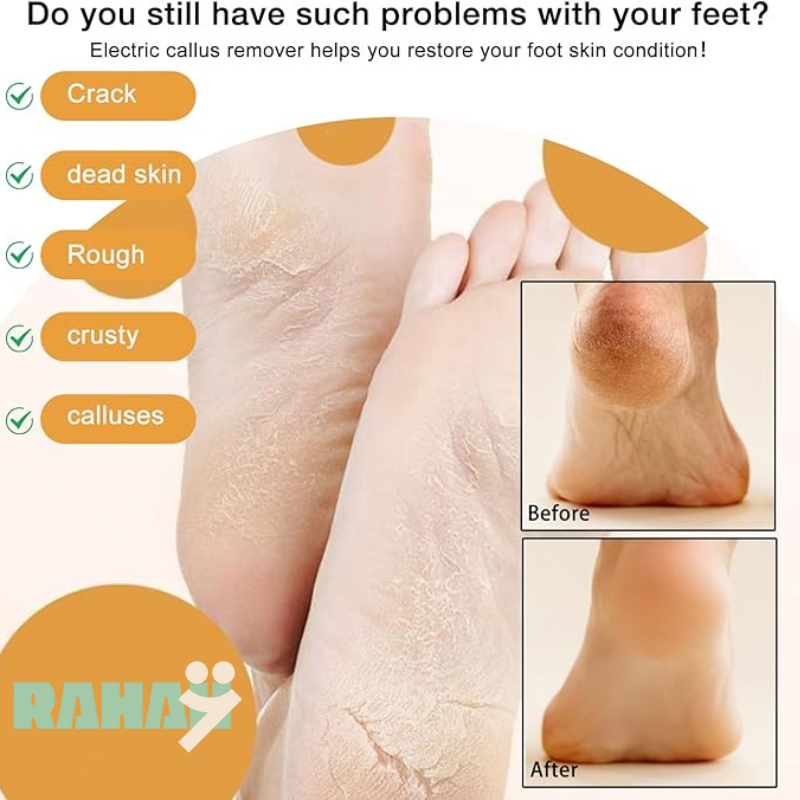 Electric Foot Callus Remover, 2024 New USB Rechargeable Foot Repair and Grinding Device, Heel Polisher Digital Display